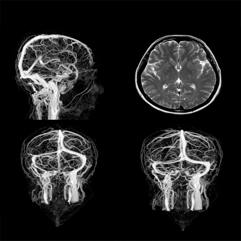 brain scans: Neuro-structural restoration - brain and nervous system connection