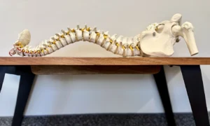 Anatomical Spine model - Chiropractic Conditions