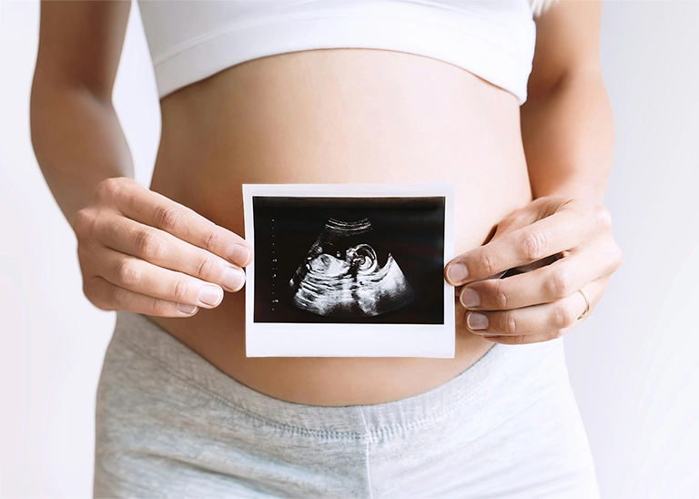 woman holding a sonogram picture over her belly - chiropractic care for pregnancy in the first trimester