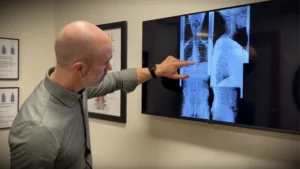 Dr Robert Mirandola - Gonstead chiropractor at The Foundation Chiropractic - pointing at patients Xrays